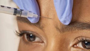 تزریق فیلر در تهران؛ 1 راه سریع برای جوانی و زیبایی